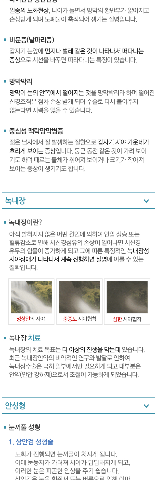 녹내장사진